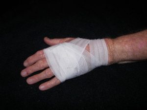 personal injury claim